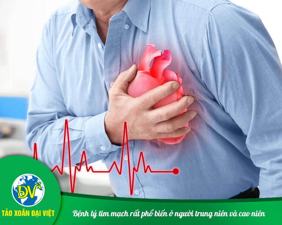 Bệnh lý tim mạch rất phổ biến ở người trung niên và cao niên