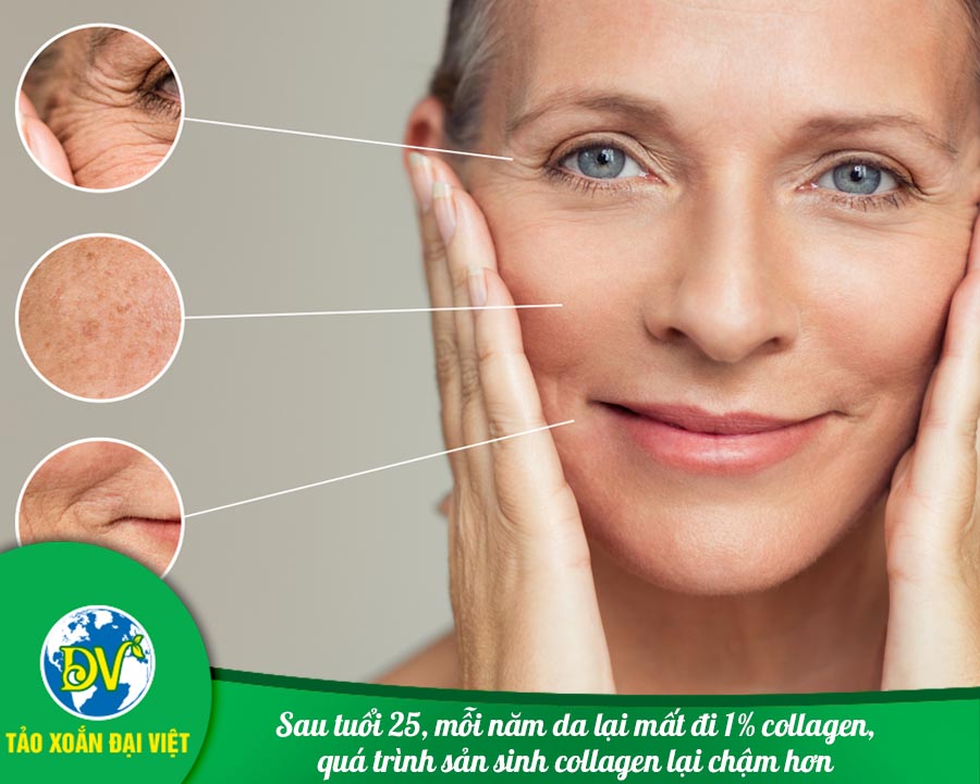 Sau tuổi 25, mỗi năm da lại mất đi 1% collagen, quá trình sản sinh collagen lại chậm hơn