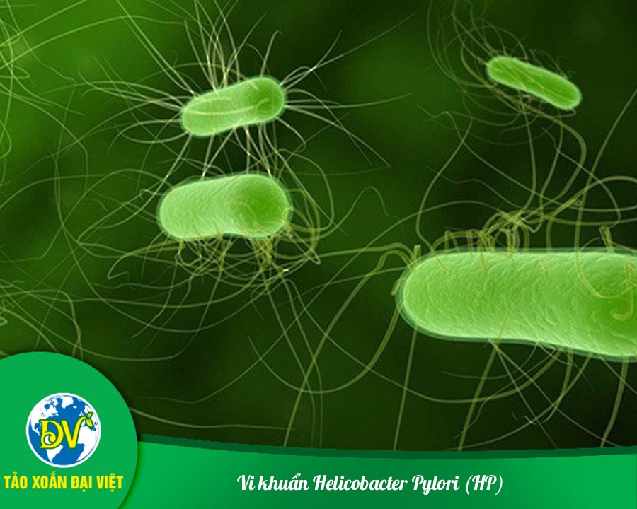 Vi khuẩn Helicobacter Pylori (HP)