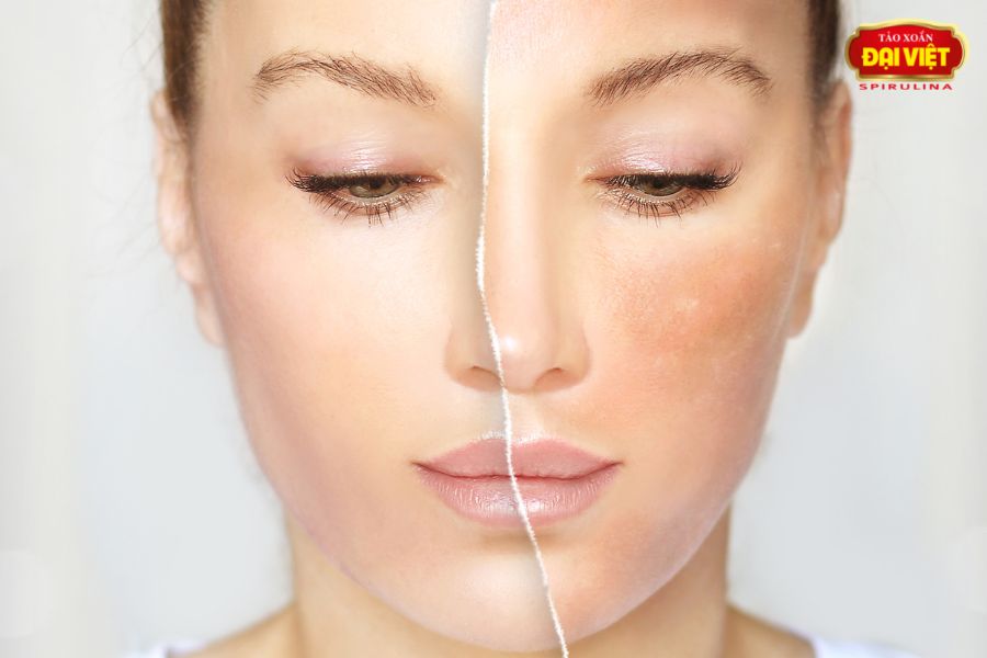 Tảo xoắn đắp mặt giúp loại bỏ độc tố ra khỏi bề mặt da