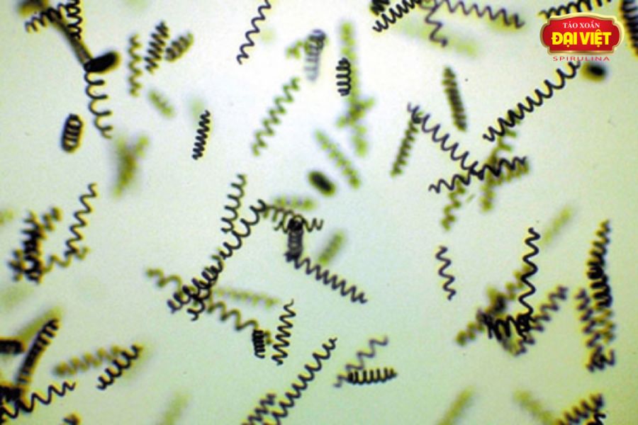 Tảo Spirulina là vi khuẩn lam có kích thước nhỏ bé, chỉ có thể nhìn rõ hình dạng dưới kính hiển vi